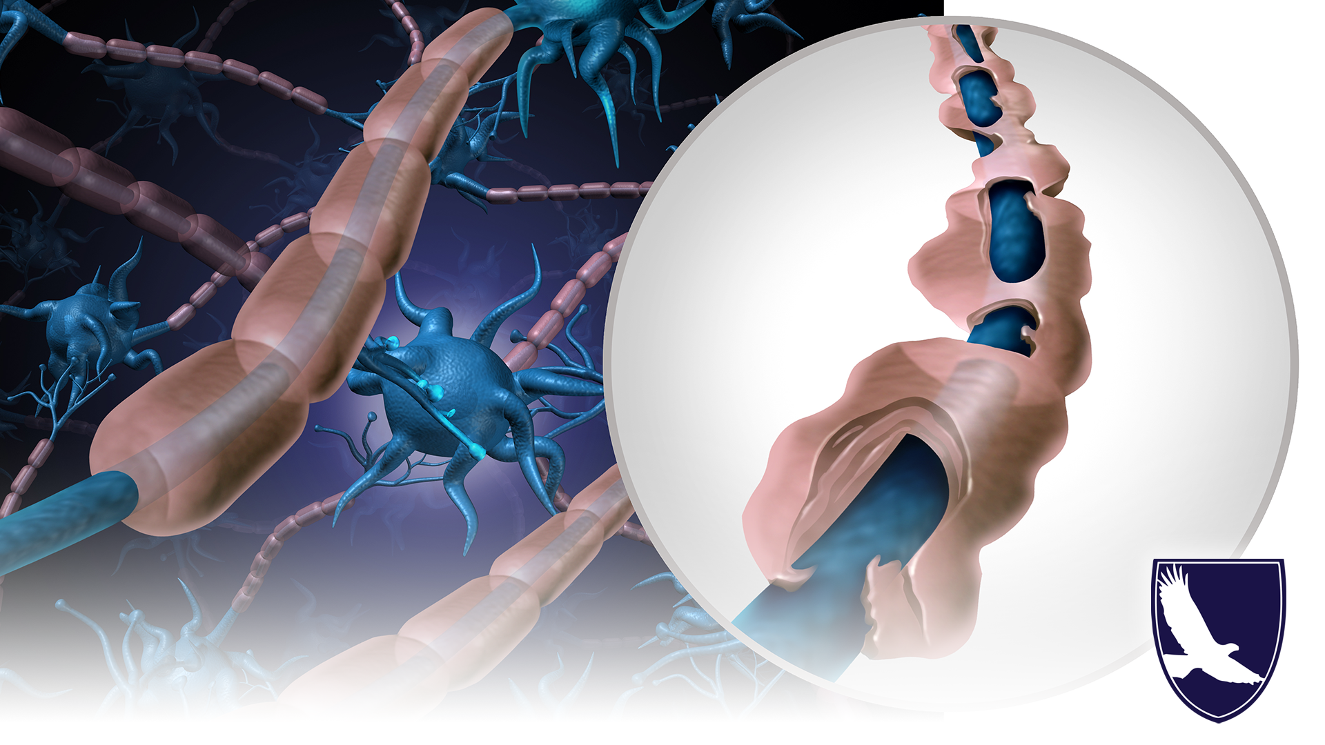 CAN I GET SSDI SSI BENEFITS FOR MULTIPLE SCLEROSIS (MS)